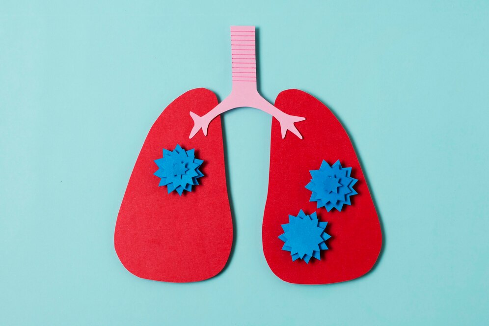 small cell lung cancer icd 10