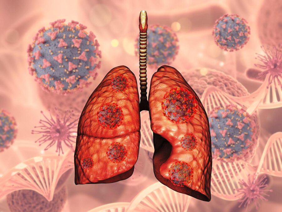 small cell lung cancer icd 10